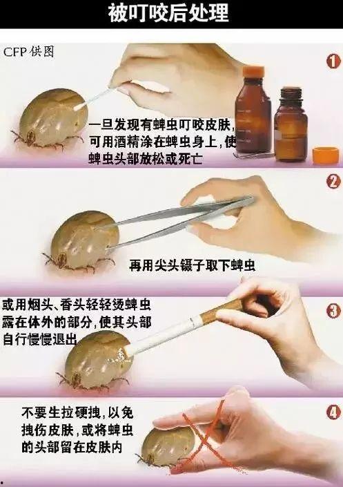 绍兴新闻爆料平台蜱虫,惊现蜱虫隐患，专家提醒防范措施！  第2张